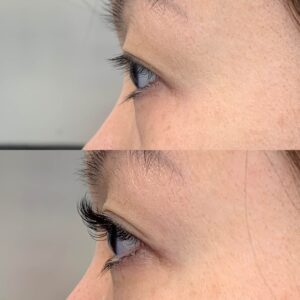 Eyewonderlust Eyelash Extensions for Asian Monolids Eyes - Before and After Cosmetic Treatment and Correction Comparison Facing Side